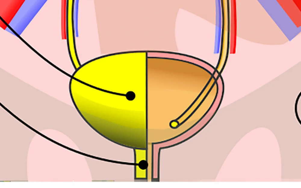 Молодые ученые изобрели синтетический мочевой пузырь
