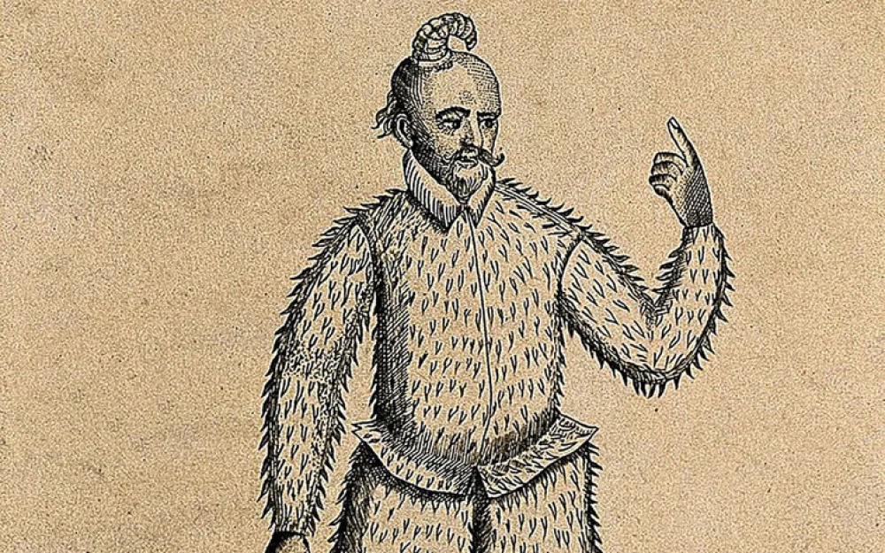 Объяснена причина появления настоящих рогов на человеческой коже