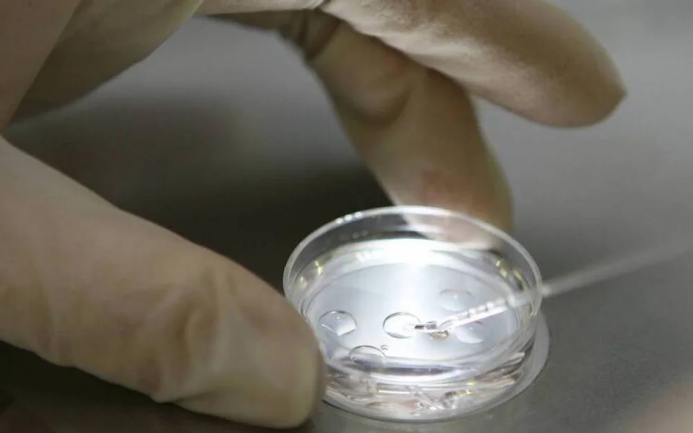 С годами мозг человека местами расширяется: выводы ученых