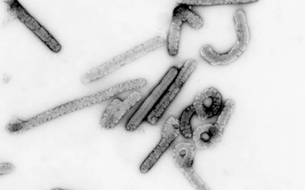 Умирает до 80 процентов: страна подтвердила вспышку смертельного вируса