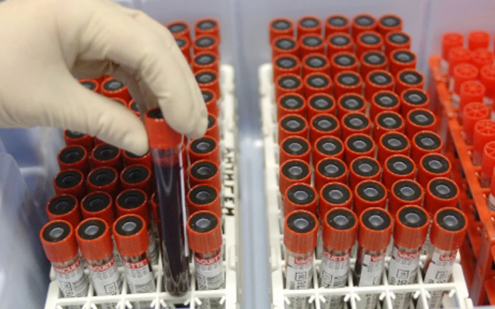 Голикова рассказала о регистре доноров костного мозга в России