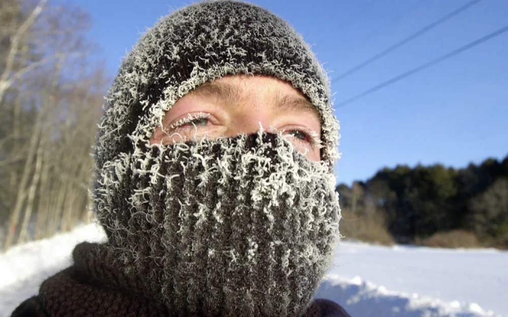 Терапевт Кондрахин: человек без головного убора зимой теряет до трети тепла тела