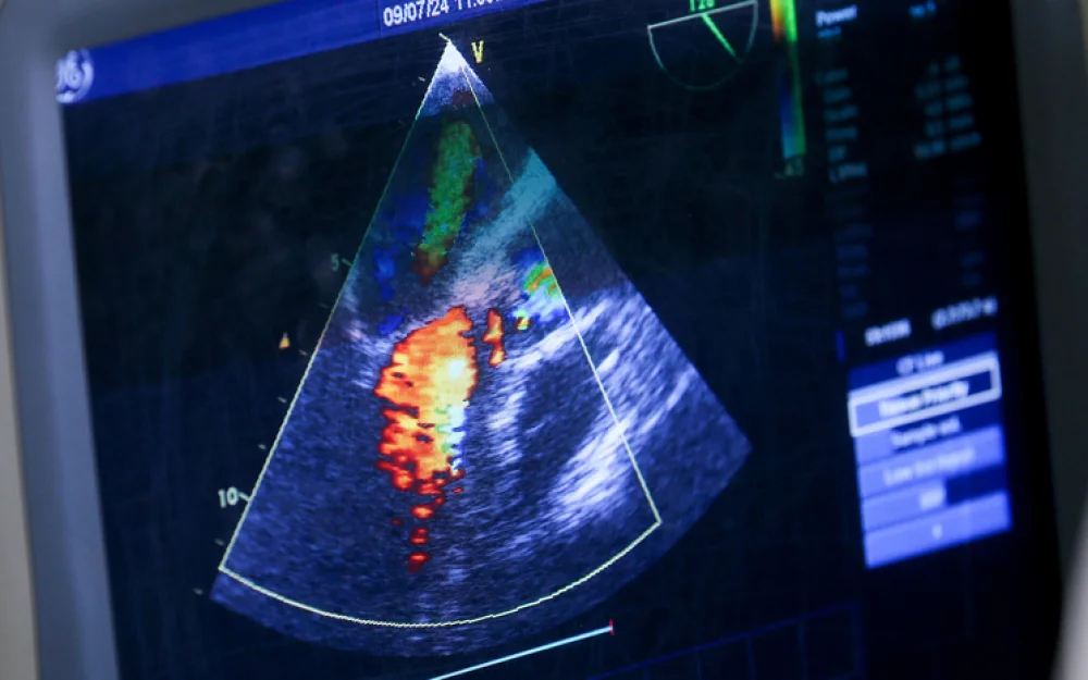 Врачи обсудили проблемы реабилитации после инфарктов и инсультов