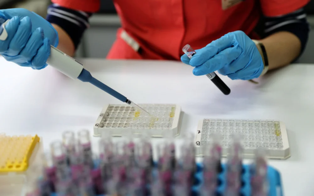 Мурашко: число новых случаев ВИЧ-инфекции в РФ в 2024 году уменьшилось на 11%